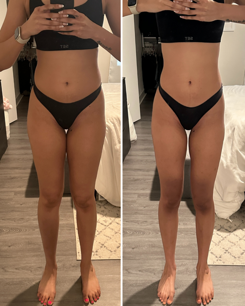 thigh gap before and after