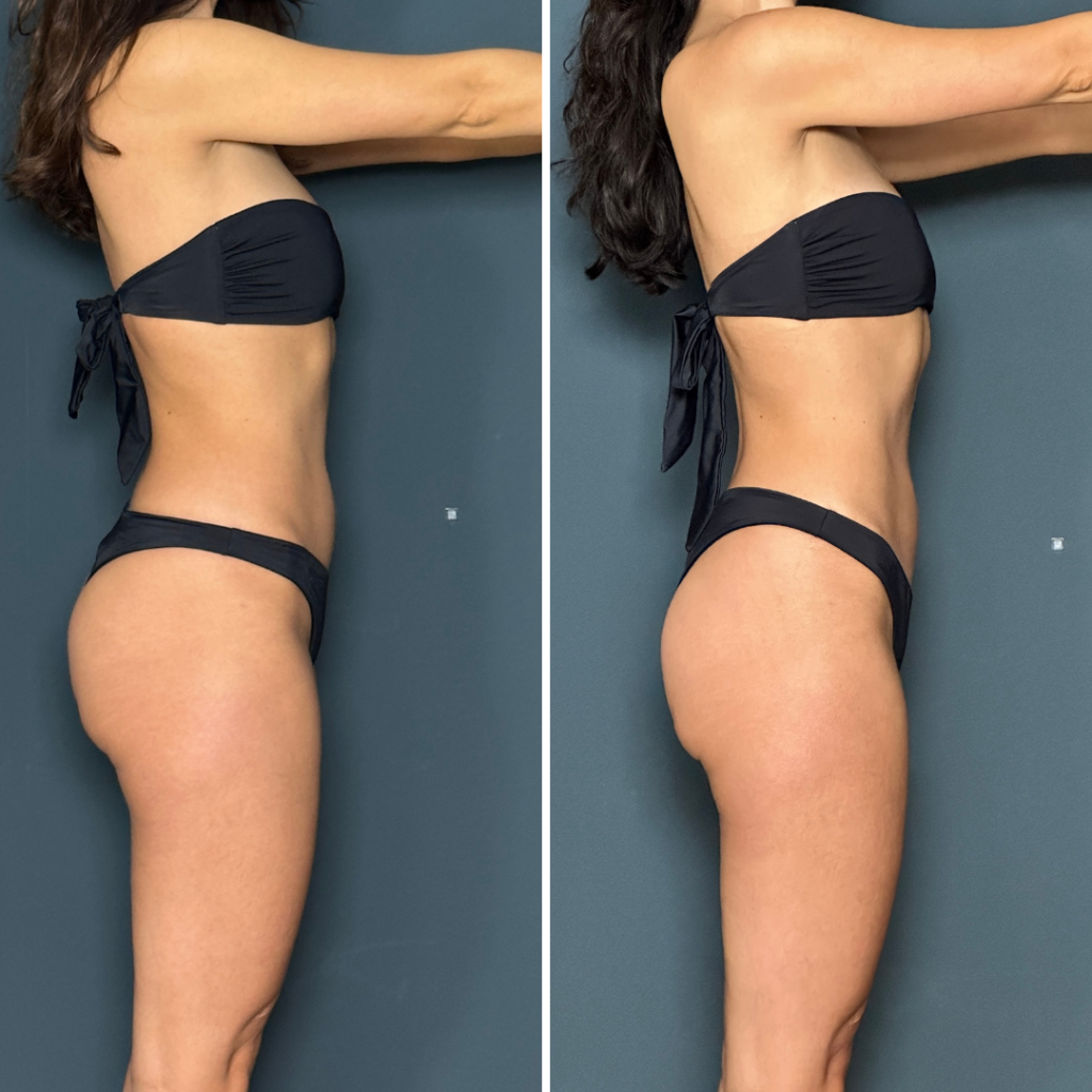 rachael attard program transformation