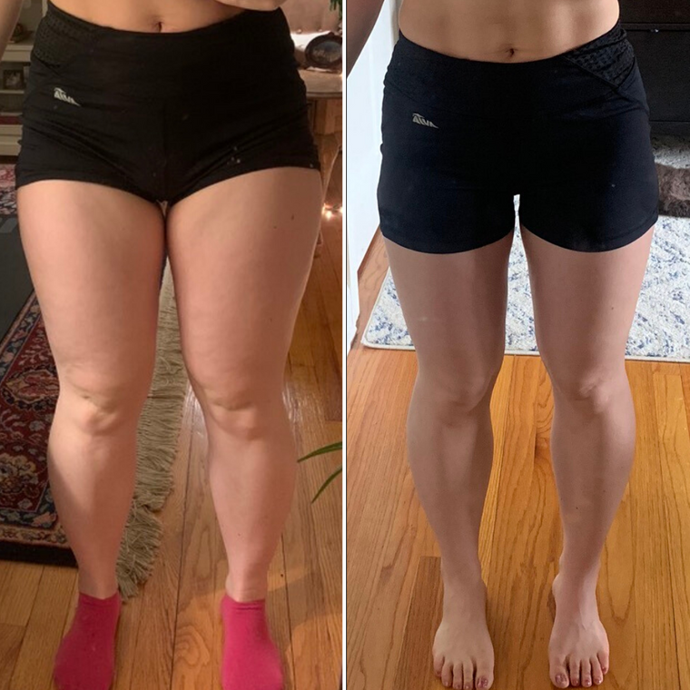 lean legs program before and after transformation